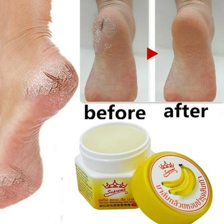 Anti Chapped Anti-Drying Crack Cream Dead Skin Remover Banana Oil
