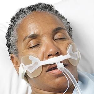 Hollister AnchorFast Oral Endotracheal Tube Fastener, 5-10 mm, 1 Count