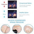 thumbnail image 5 of Decompression Back Belt Lumbar Spine Support For Lower Back Pain, 5 of 5