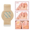 thumbnail image 2 of Nail Patch LTQXGT, tratamiento antihongos para uñas, extra fuerte, 21 unidades, 2 of 7