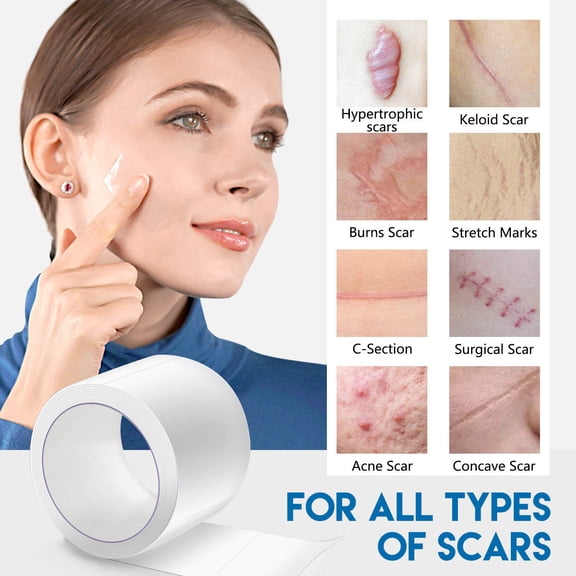 Reusable Scar Removal Patch Roll, Medical-Grade Silicone Tape for C-Section & Keloids - 1.5Mx2.5CM Self-Adhesive Scar Treatment