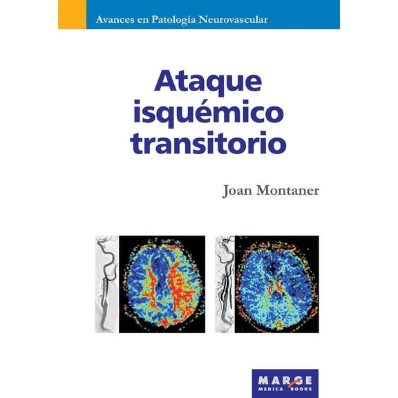 Ataque isquÃ©mico transitorio, (Paperback)