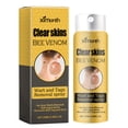 thumbnail image 3 of Etiqueta de remover spray de piel lisa Voluntad y etiquetas de eliminación de la crema de tratamiento de la crema suave y rápida Réguee Spray adecuado para hombres y mujeres, 3 of 9