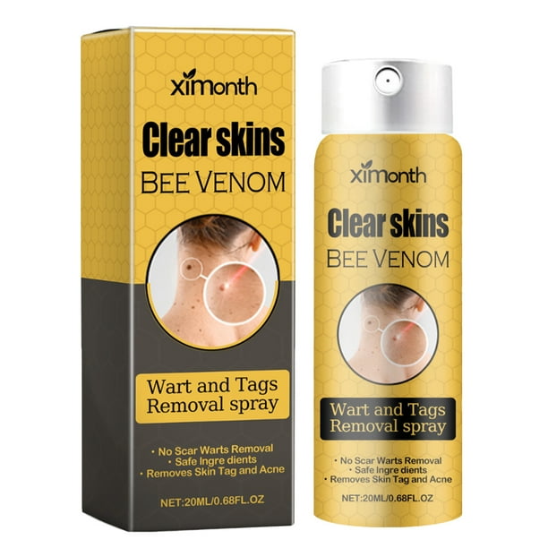 Spray Eliminador Verrugas para Tratamiento Lunares Y Adecuada Hombres Mujeres