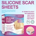 thumbnail image 6 of Silicone Scar Sheets Roll - Helps Support Scar Appearance for Old & New Scars, Cut-to-Size (1.6" x 75"), 6 of 10