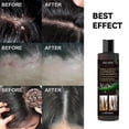 thumbnail image 2 of 100ml Anti-dandruff And Anti-itch Shampoo Anti-dandruff And Anti-itch Shampoo Anti-dandruff, 2 of 5