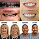 thumbnail image 4 of Dientes artificiales Dentaduras Temporales Prótesis dentales rápidas Carillas de sonrisas perfectas, Repare su diente rápidamente, Haga que sonría con confianza Ormromra LKX-1380, 4 of 7