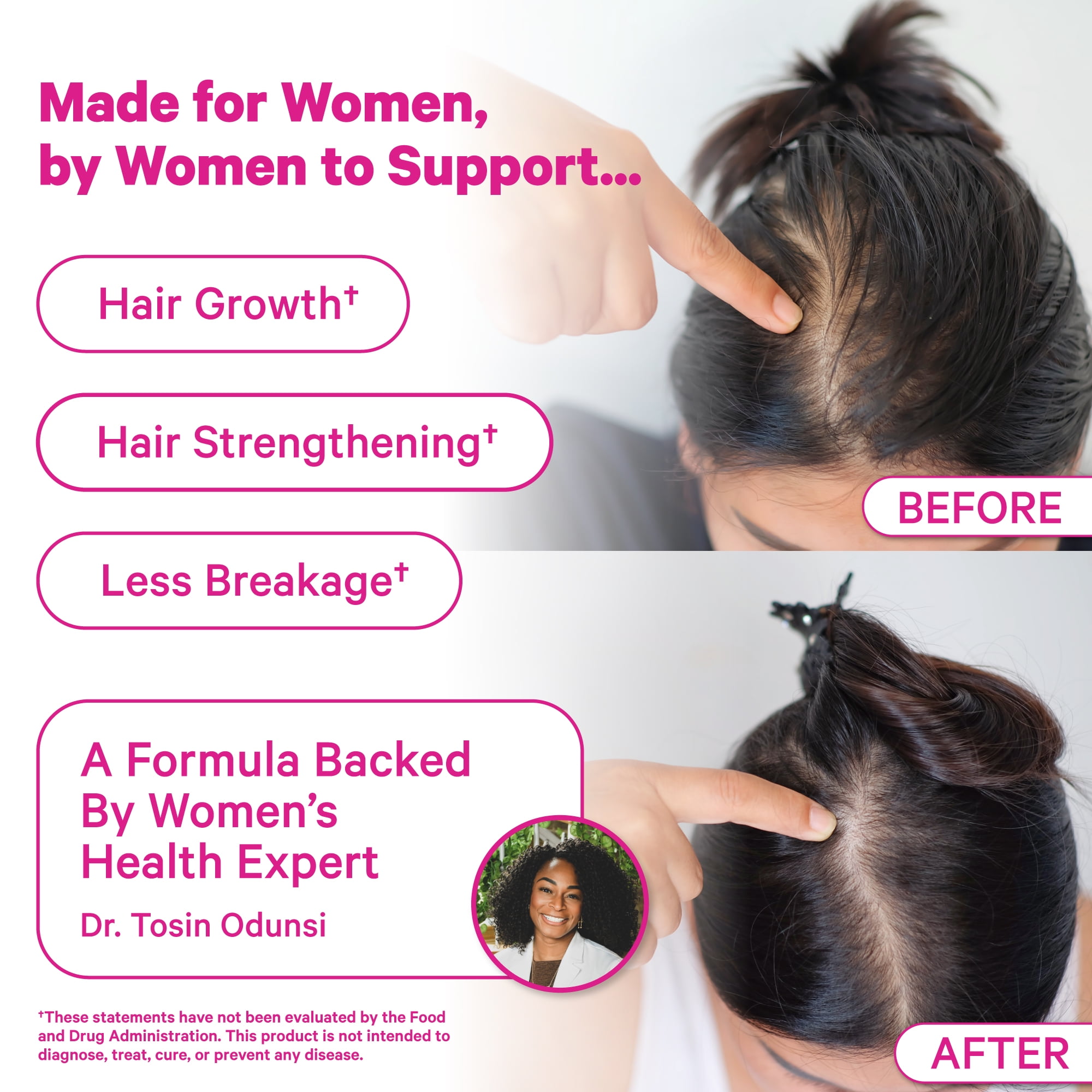 Pink Stork Postpartum Hair Loss Gummies, Biotin Hair Skin + Nails Vitamins, 60 Count