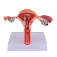 thumbnail image 2 of Female Uterus Structure Biological Models Educational Experiment, 2 of 4