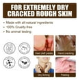 TWCTUWEN Cracked Skin Repairs Creams Cracked Heel Repairs Hand And Foot