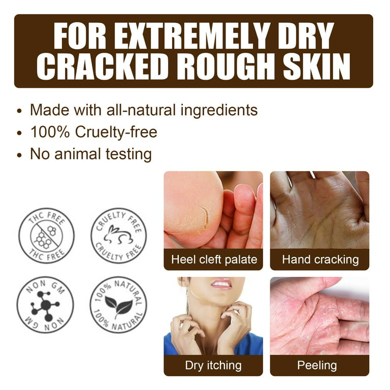 Smartdrops Chapped Hand And Foot Cream Crack Peeling Repair Anti Dry Skin Remove  Dead Skin Foot Moisturizing (50gm) (For Women and men) Pack of 4