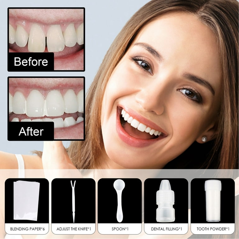 Tooth Repair Kit, Fixing The Missing and Broken Tooth Replacements