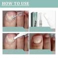 thumbnail image 2 of 4ml Nail Care Pen, Health Nail Care Pen Routine, Nail Repair Pen Nail Treatment Pen for Nourished Fingernails and Toenails, 2 of 4
