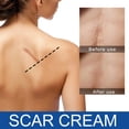 thumbnail image 4 of Scar Cream, Scar Serum, Stretch Marks Removal Skin Repair Cream Scar Removal Cream Scar Removal Cream the skin to improve the skin contour(3pcs), 4 of 5
