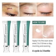 thumbnail image 3 of Breylee Acne Scar Removal Cream: 30g, Skin Repair (1pcs), 3 of 5