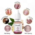 thumbnail image 2 of Nail Treatment Polish for Fungal Repair and Growth Promotion 10ml, 2 of 5