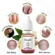 thumbnail image 2 of Nail Treatment Polish for Fungal Repair and Growth Promotion 10ml, 2 of 5