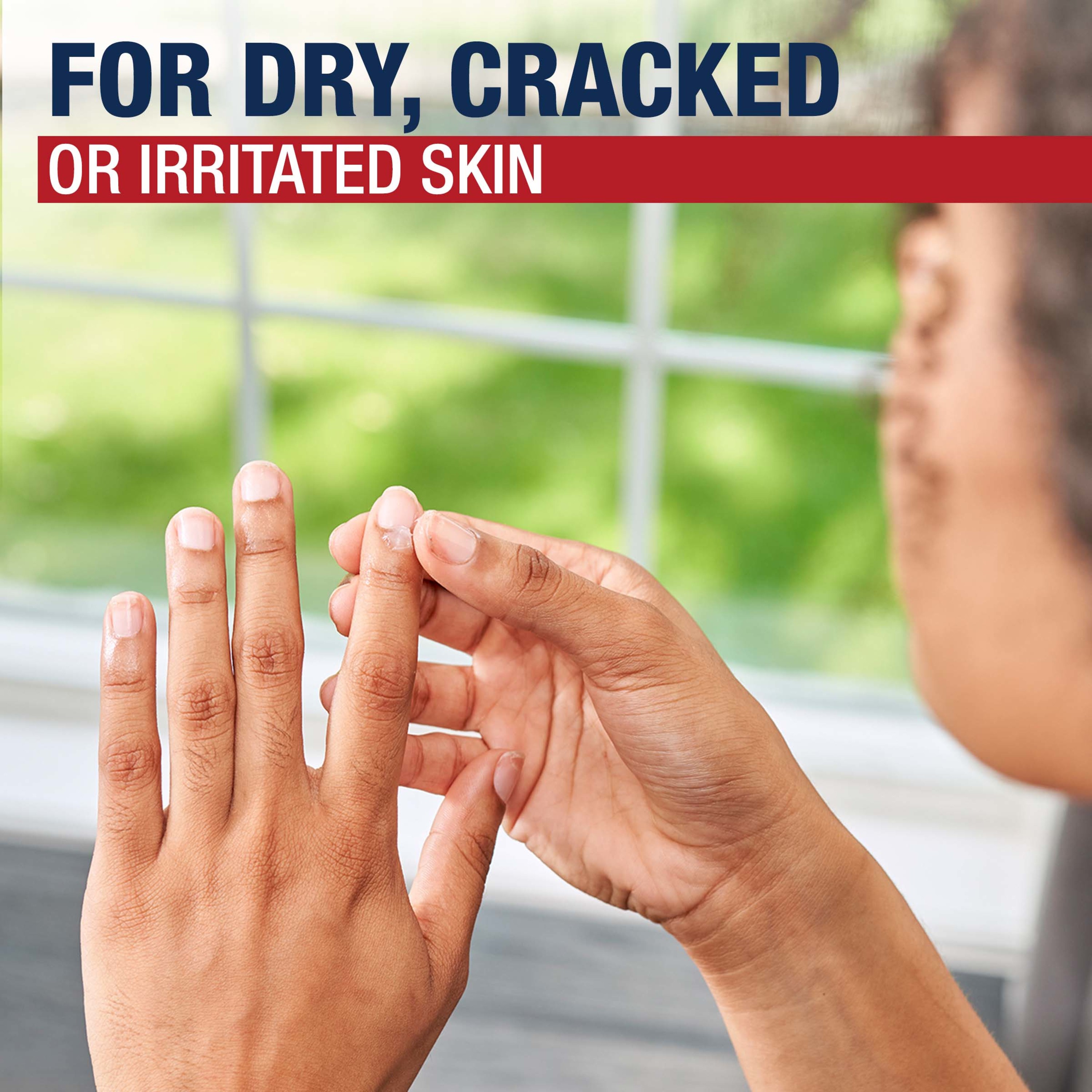 Aquaphor Healing Ointment Skin Protectant, Use After Hand Washing, 1.75 oz. Tube - image 5 of 17