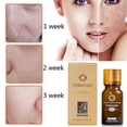 thumbnail image 4 of 2 Pcs Brightening Spotless Oil Dark Spots Removal Age Hyper Pigmentation 10ml, 4 of 5
