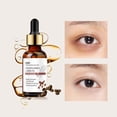 thumbnail image 1 of Fiudx Ofertas Del Día Suero Para Ojos Con Cafeína 30Ml Bolsa Para Ojos Hidratante E Iluminadora, 1 of 6