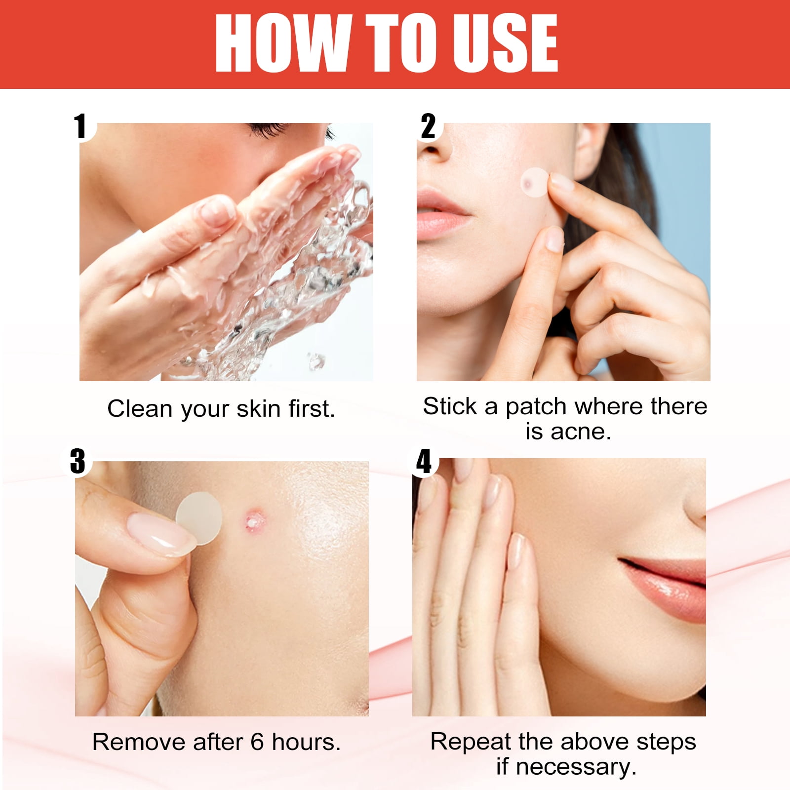 Alvantor Pimple Patches for Face, Day/Nighttime Hydrocolloid Acne Patches, 144 Count