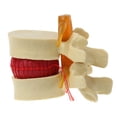 thumbnail image 1 of Transemion Flexible And Compact Anatomical Spine Lumbar Disc Model Versatile And Practical For Training yellow 1Set, 1 of 6