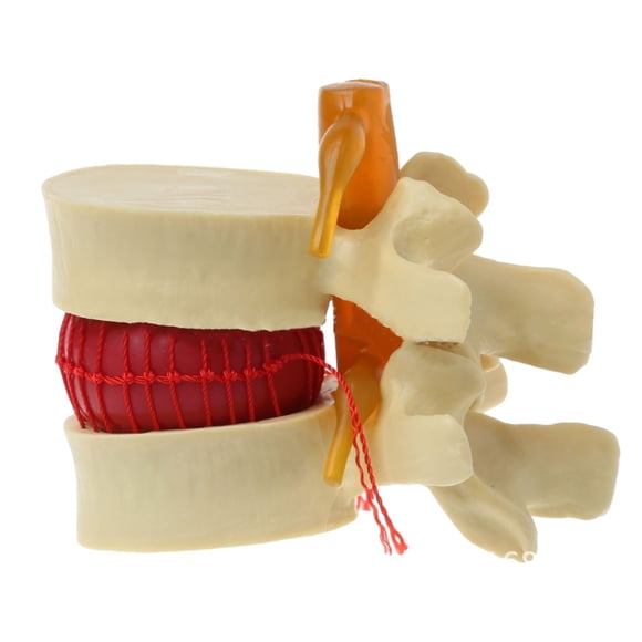 Modelo anatómico de disco lumbar Speravity para demostraciones médicas precisas Material de laboratorio amarillo