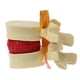 thumbnail image 1 of Modelo anatómico de disco lumbar Speravity para demostraciones médicas precisas Material de laboratorio amarillo, 1 of 6