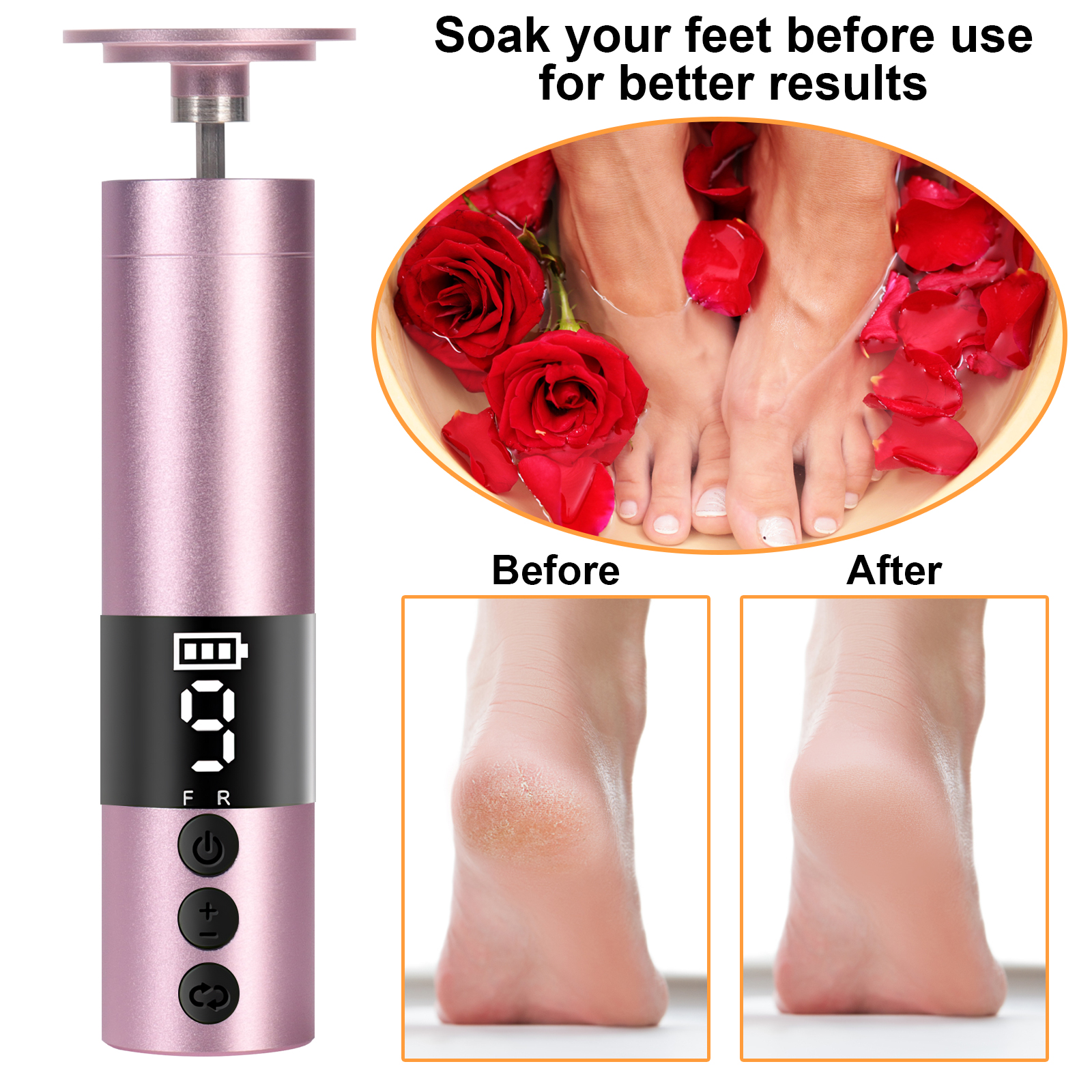 Eurhowing Electric Foot Callus Remover, Rechargeable Foot File with 20 Sandpaper Disks, Portable Pedicure Tools for Hard Skin, Pink