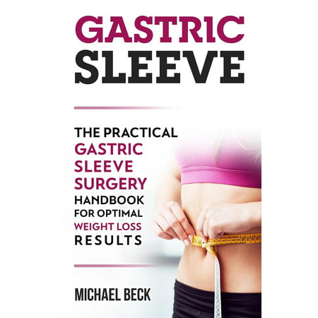 Gastric Sleeve : The Practical Gastric Sleeve Surgery Handbook for Optimal Weight Loss