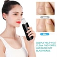 thumbnail image 4 of Face Skin Scrubber USB Rechargeable Peeling Machine Ultrasonic Exfoliating SkinCare(Black ), 4 of 5