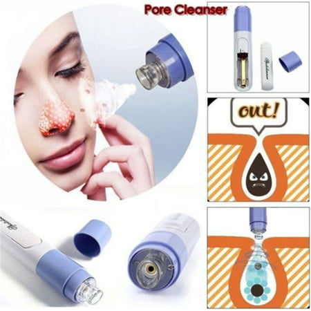Blackhead Removal Electric Blackhead Extractor Tool Skin Cleanser Minimizes Large Pores Blackhead Vacuum Suction Remover for Acne and Facial Pore Clean Skin-caring (Best Treatment For Blackheads And Large Pores)