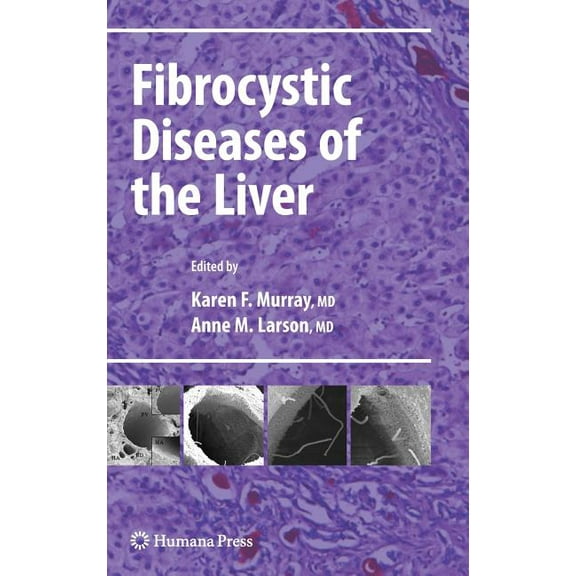 Clinical Gastroenterology Fibrocystic Diseases of the Liver, (Hardcover)