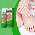 thumbnail image 2 of Nail Treatment Spray, Nail Fungus Treatment Toenail Cuticle Care Spray, Nail Growth Serum, Nail Repair Spray for Your nails a Natural Shine, 2 of 5
