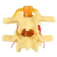 thumbnail image 2 of 1:1.5 Anatomical  Human Lumbar Degenerative Lumbar Disc Herniation Demonstration Model Human Spine, 2 of 8