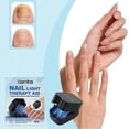 thumbnail image 5 of Nail Fungus LED Light Device Nail Fungus Light Device Effective Rechargeable, 5 of 5