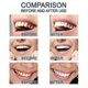thumbnail image 4 of New Teeth Whitening Essences Extra Strong White Hygiene Tooth Whitener Stain Removal Oral Hygiene Whitening Gel Remove Plaque And Stains Cleaning Tw,1Set, 4 of 5