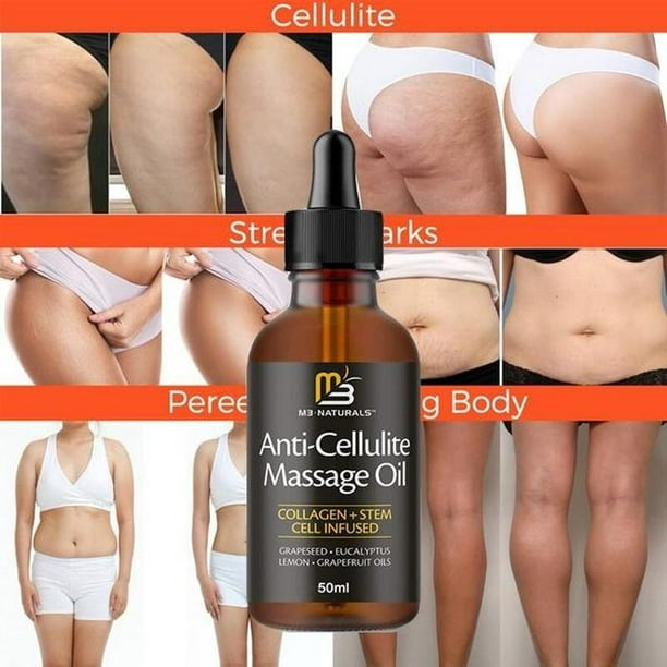 Anti-Cellulite Massage Oil Infused with Collagen and Stem Cells Helps Firm  Strengthen Skin Remove Cellulite Stretch Marks