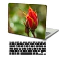 thumbnail image 3 of KSK KAISHEK Hard Shell Case Only Compatible 2016-2022 Release Newest MacBook Pro 13 inchs with + Black Keyboard Cover Model: M1 A2338/A2289/A2251/A2159/A1989/A1706/A1708 Rose series 0798, 3 of 5