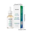 thumbnail image 3 of Facial Chemical Exfoliating Is Applicable To Acne And Freckle Removal To Improve Pore Size And Even Skin Color, 30ML, 3 of 4