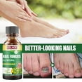 Nail Fungus Treatment, Restores the Healthy Appearance of Nails(08)