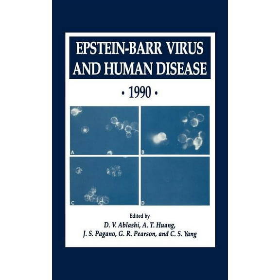 Experimental Biology and Medicine Epstein-Barr Virus and Human Disease - 1990, Book 24, (Hardcover)