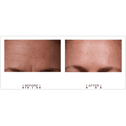 SilcSkin Full Face Set