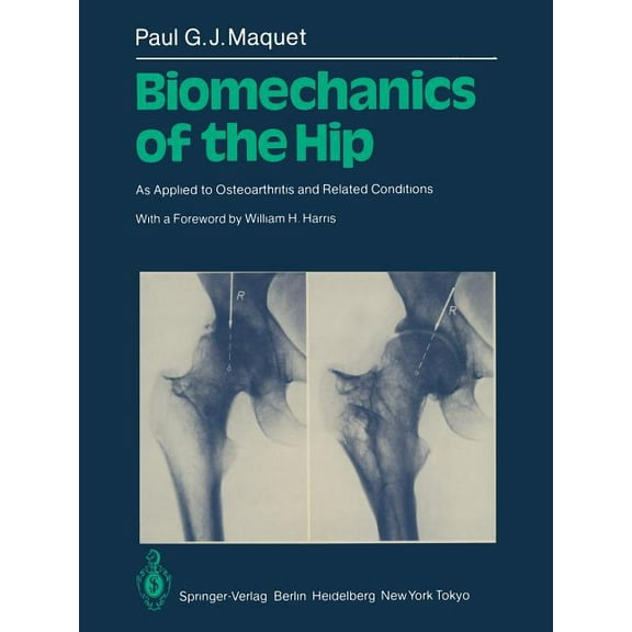 Biomechanics of the Hip: As Applied to Osteoarthritis and Related Conditions, (Paperback)