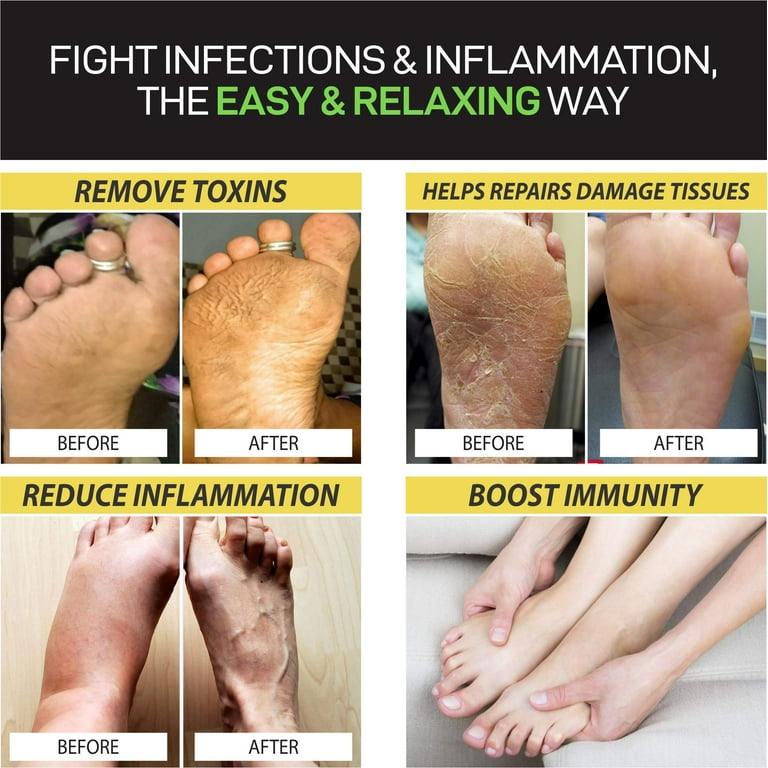 Citrus Detox Foot Soak with Epsom Salt Removes Toxins, Helps