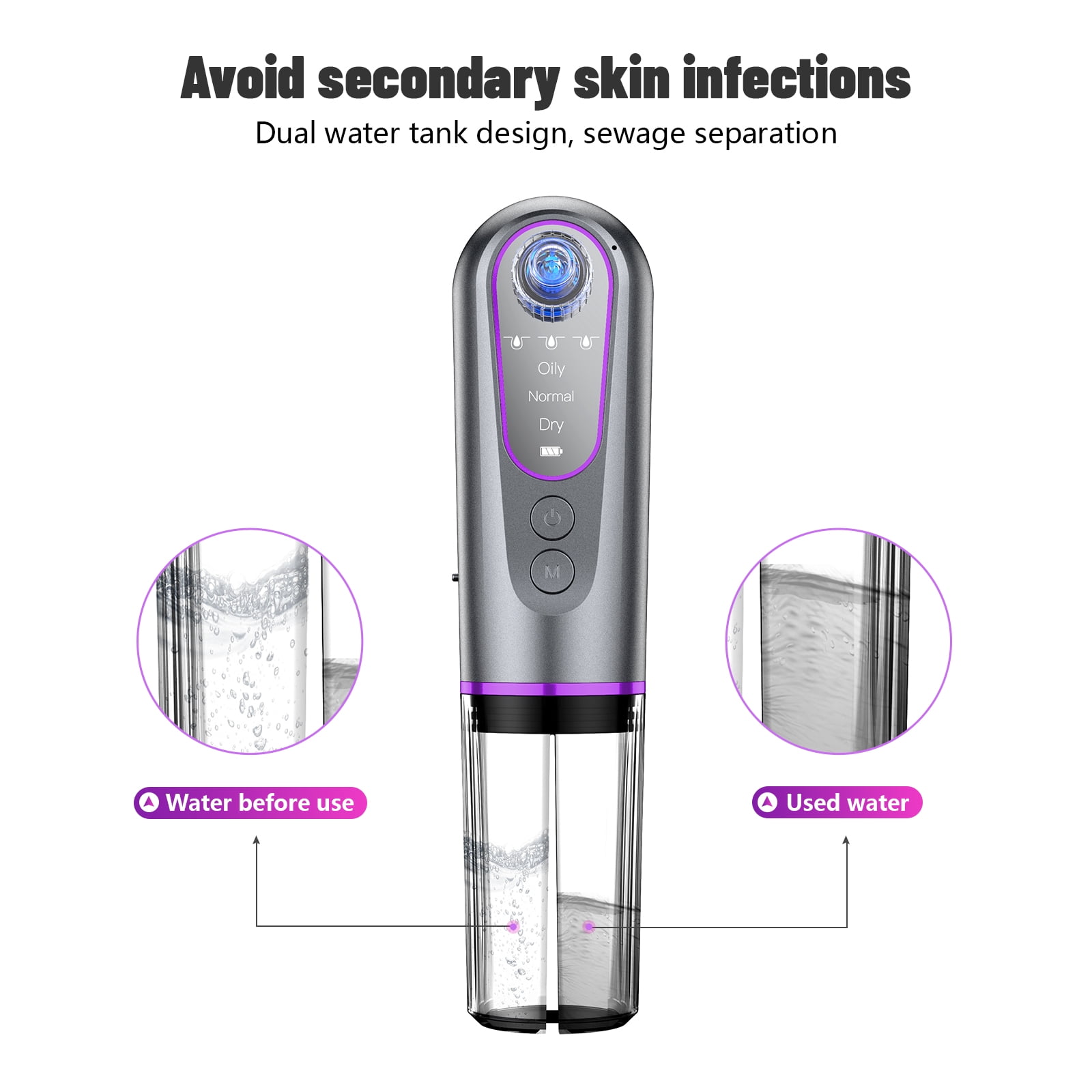 JUUTREN Blackhead Remover Pore Vacuum for Face, Water Cycle Facial  Pore Cleanser with 3 Suction Levels, 5 Heads for Deep Cleansing & Skin Care, Electric Facial Cleansing Tool for Women & Men