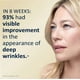 thumbnail image 3 of RoC Retinol Correxion Deep Wrinkle Anti-Aging Night Cream RoC RoC, 3 of 7