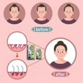 thumbnail image 4 of Ginger Plant Extract Anti-hair Loss Hair Shampoo, 2024 New Ginger Plant Extract Anti-hair Loss Hair Shampoo, Ginger Shampoo For Hair Growth, 4 of 5