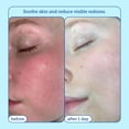 thumbnail image 4 of Kit Skincare Skinfix Barrier+ Better Skin con minicrema, limpiador y sérum, 4 of 6