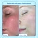 thumbnail image 4 of Kit Skincare Skinfix Barrier+ Better Skin con minicrema, limpiador y sérum, 4 of 6